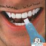 Ослепительная белизна ваших зубов